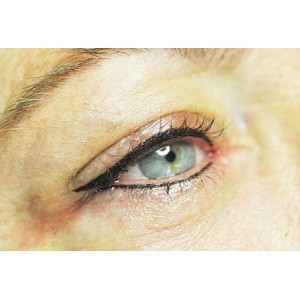 Maquillage permanent du eyeliner large (haut ET bas) Maquillage permanent du eyeliner large (haut ET bas)